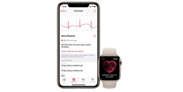 Apple comenzará a realizar estudios médicos a través del iPhone y su reloj  inteligente