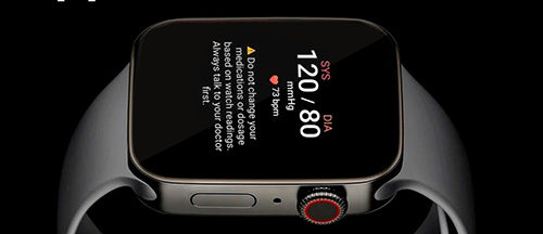 Da iPhoneIslam.com, un primo piano di una serie di Apple Watch L'orologio ha un cinturino nero e un pulsante rosso della corona digitale, per commemorare il decimo anniversario dal suo debutto rivoluzionario all'evento del 120 settembre.