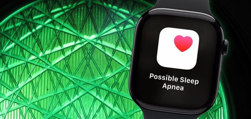 من iPhoneIslam.com، تعرض ساعة Apple Watch، بحزامها الأسود الأنيق، إشعارًا يقرأ "احتمال انقطاع التنفس أثناء النوم" على خلفية هندسية خضراء، مما يؤكد أهمية اكتشاف توقف التنفس أثناء النوم من أجل صحتك.